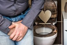 為何男性攝護腺會肥大？症狀與治療方式有哪些？
