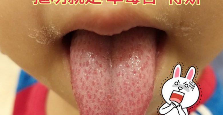 草莓舌！-810x662