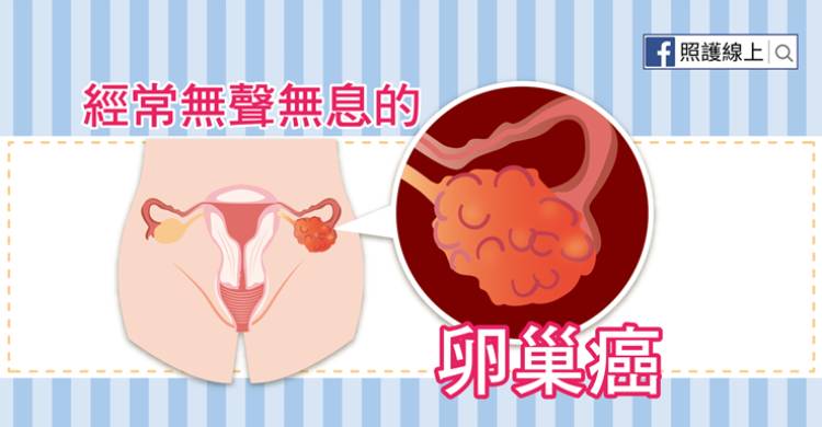 經常無聲無息的 – 卵巢癌(懶人包)
