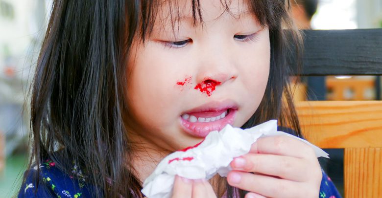 秋冬時節「鼻腔乾燥」容易出現流鼻血!可透過三個方向進行改善