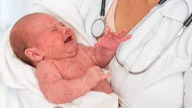 預防麻疹最好的方式？幼童與成人有哪些注意事項？