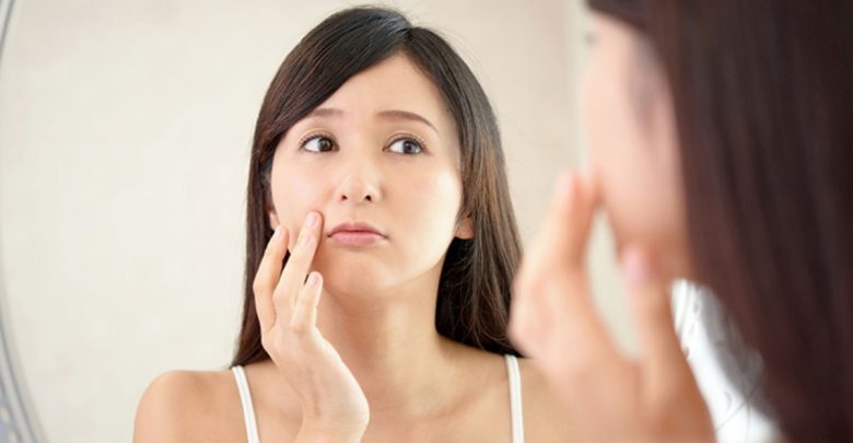 中醫讓妳全面抗痘,內服外治聰明使用綠豆、薏仁湯方調理