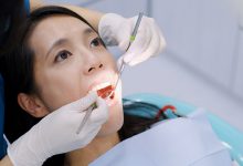 定期洗牙是清除牙結石的必要之舉，哪4種人須注意並預先告知？