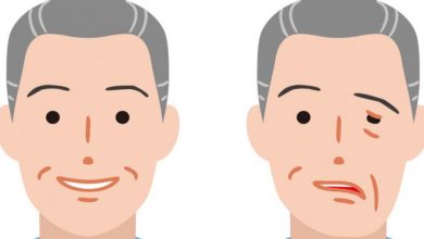 秋冬好發顏面神經麻痺，中醫師教導如何按摩放鬆