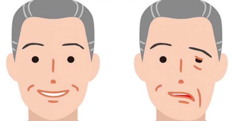秋冬好發顏面神經麻痺，中醫師教導如何按摩放鬆