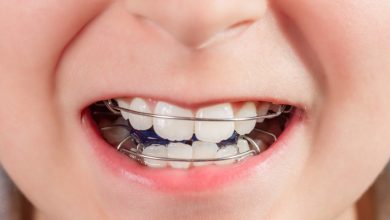兒童齙牙別擔心！醫師告訴你暴牙原因與矯正時機